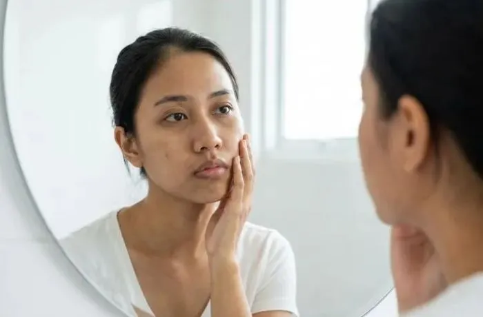 7 Cara Mengatasi Wajah Kusam saat Hamil dan Pasca Melahirkan