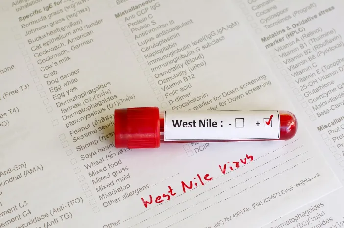 Infeksi Virus West Nile